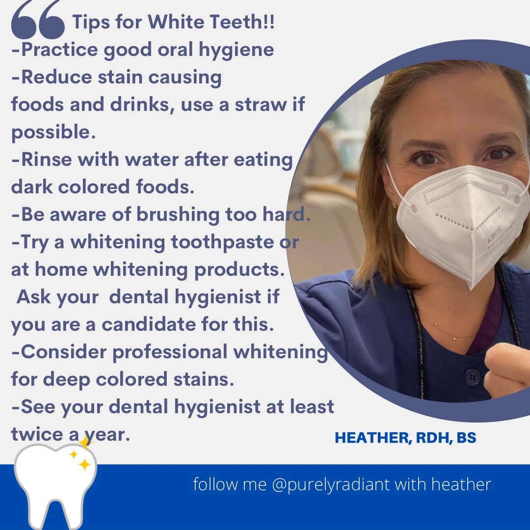Tips for White Teeth